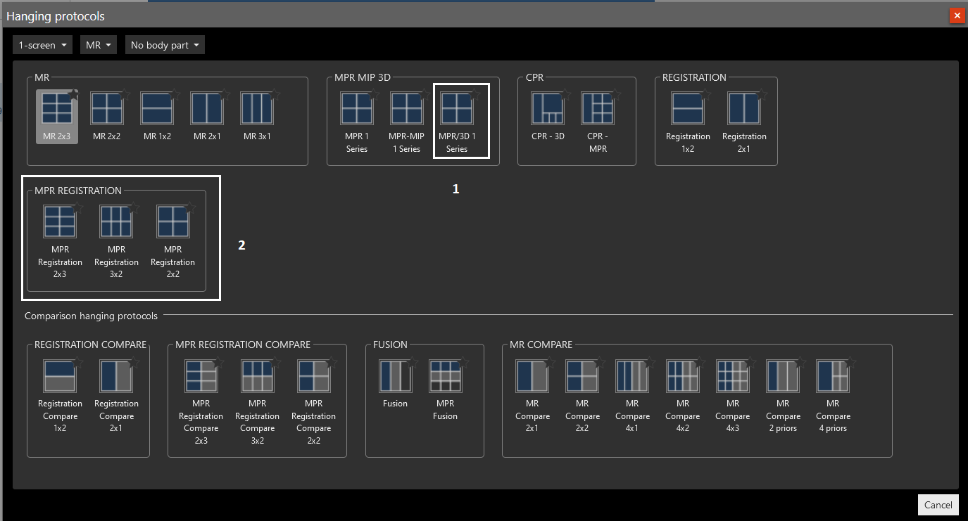 Hanging protocols and presentation groups can be moved, copied and deleted from the hanging protocol gallery.
