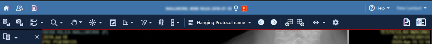 The previous and next buttons are located in the top toolbar.
